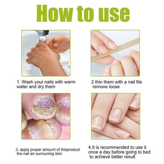EELHOE - Nail Treatment Repair Gel