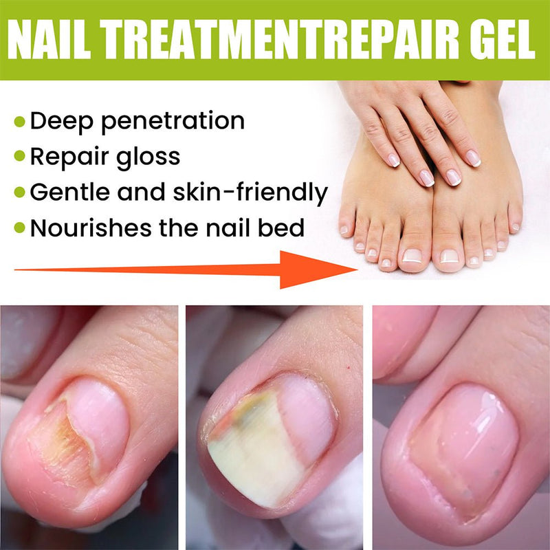 EELHOE - Nail Treatment Repair Gel